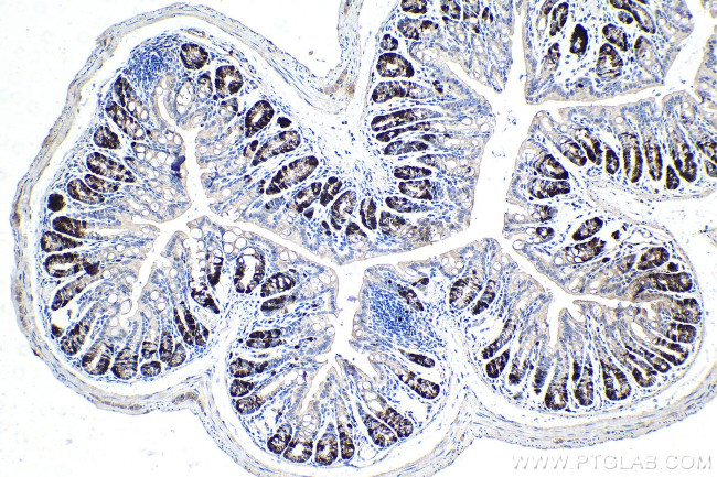 Cyclin A2 Antibody in Immunohistochemistry (Paraffin) (IHC (P))