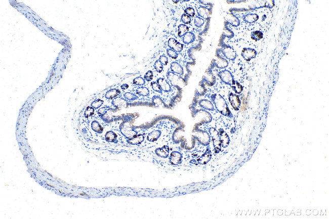 Cyclin A2 Antibody in Immunohistochemistry (Paraffin) (IHC (P))