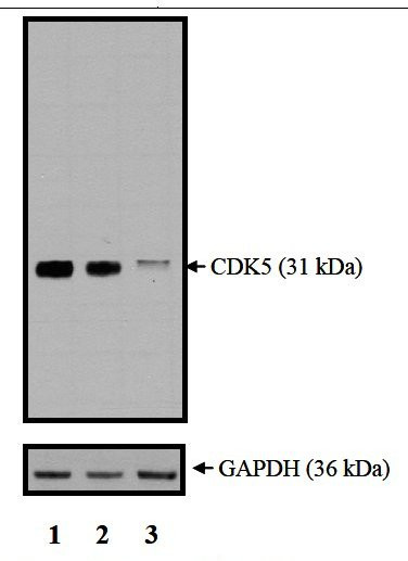 CDK5 Antibody in Western Blot (WB)