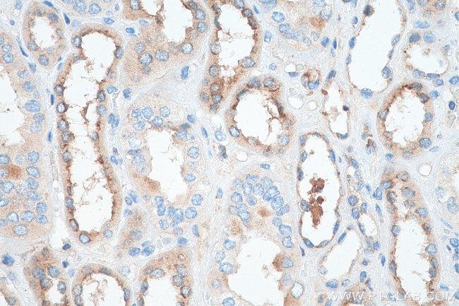 Cystatin C Antibody in Immunohistochemistry (Paraffin) (IHC (P))