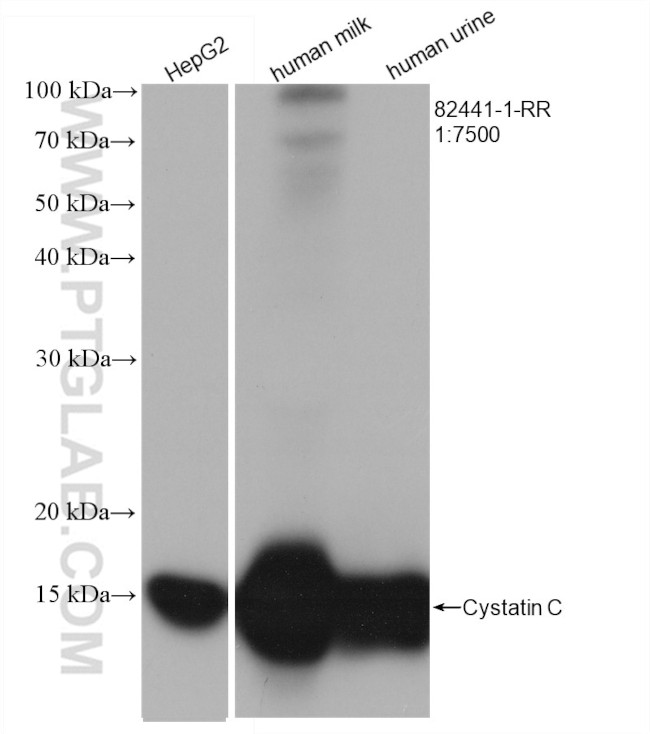 Cystatin C Antibody in Western Blot (WB)