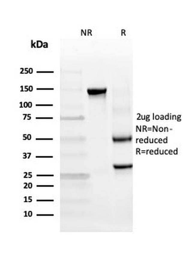 Insulinoma Associated 2/INSM2 Antibody in SDS-PAGE (SDS-PAGE)
