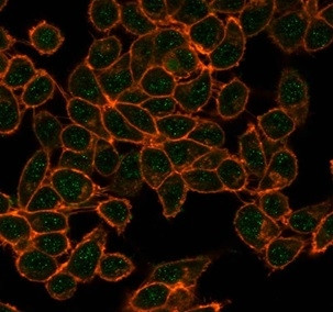 CBFB/PEBP2beta Antibody in Immunocytochemistry (ICC/IF)