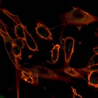 CBFB/PEBP2beta Antibody in Immunocytochemistry (ICC/IF)