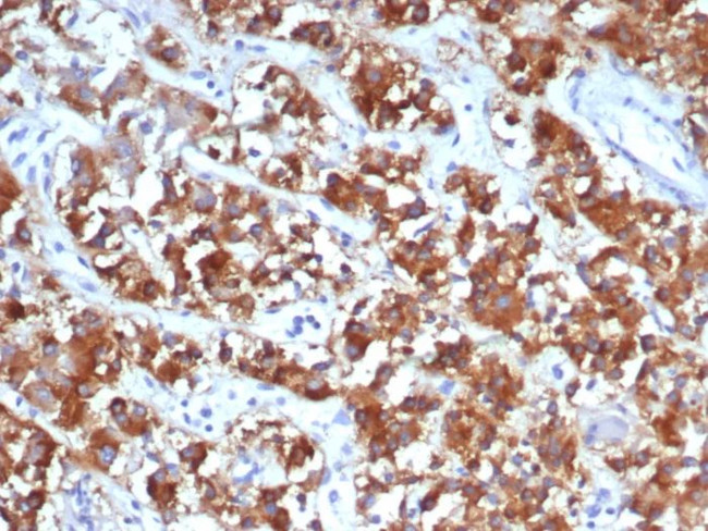 IL18R1 Antibody in Immunohistochemistry (Paraffin) (IHC (P))