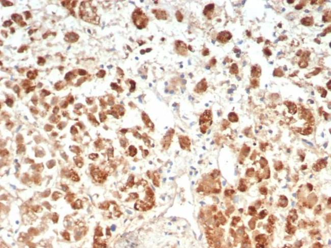 IL18R1 Antibody in Immunohistochemistry (Paraffin) (IHC (P))