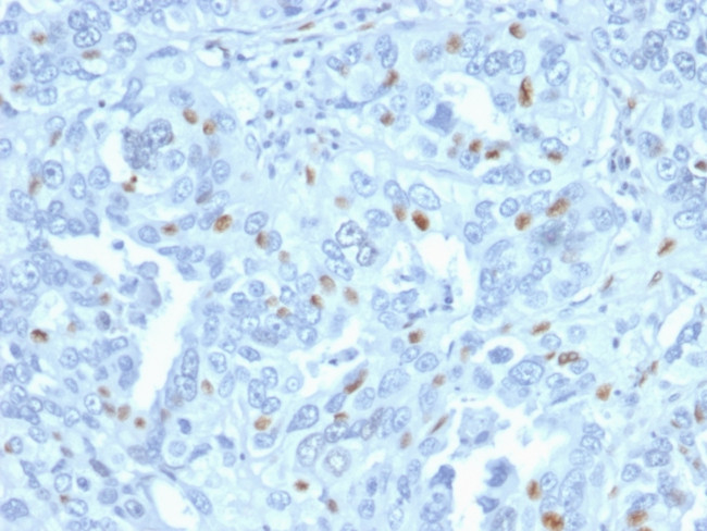 Cyclin A2 (S- and G2-phase Cyclin) Antibody in Immunohistochemistry (Paraffin) (IHC (P))