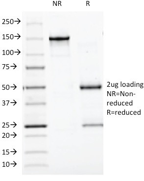 BCL10 (MALT-Lymphoma Marker) Antibody in SDS-PAGE (SDS-PAGE)