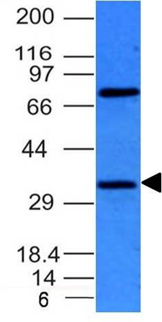 BCL10 (MALT-Lymphoma Marker) Antibody in Western Blot (WB)