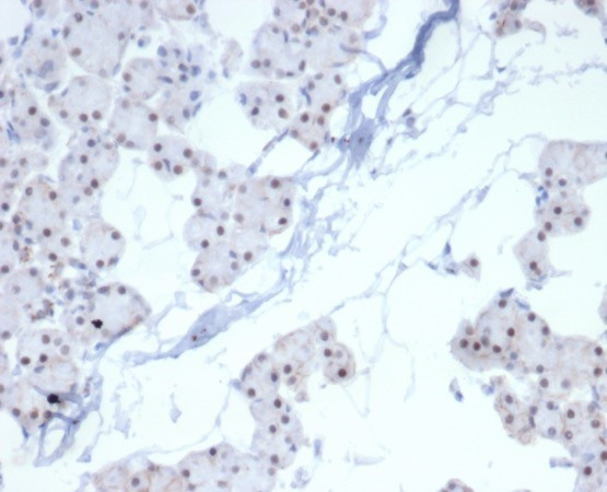 PHOX2B Antibody in Immunohistochemistry (Paraffin) (IHC (P))