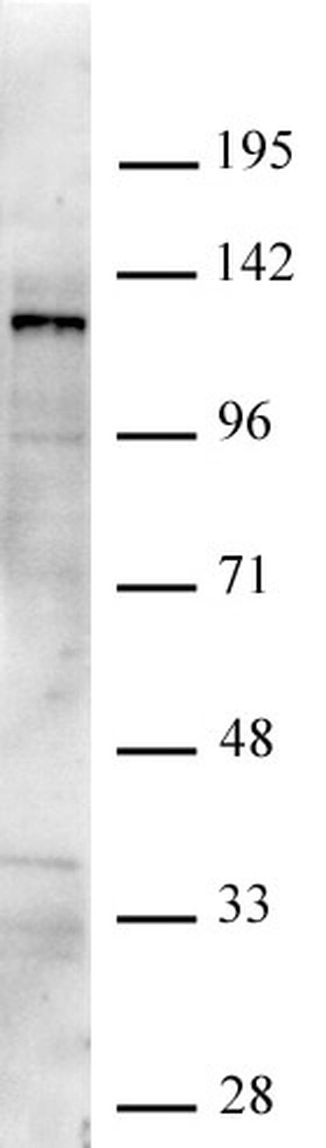 JMJD2C/KDM4C Antibody in Western Blot (WB)