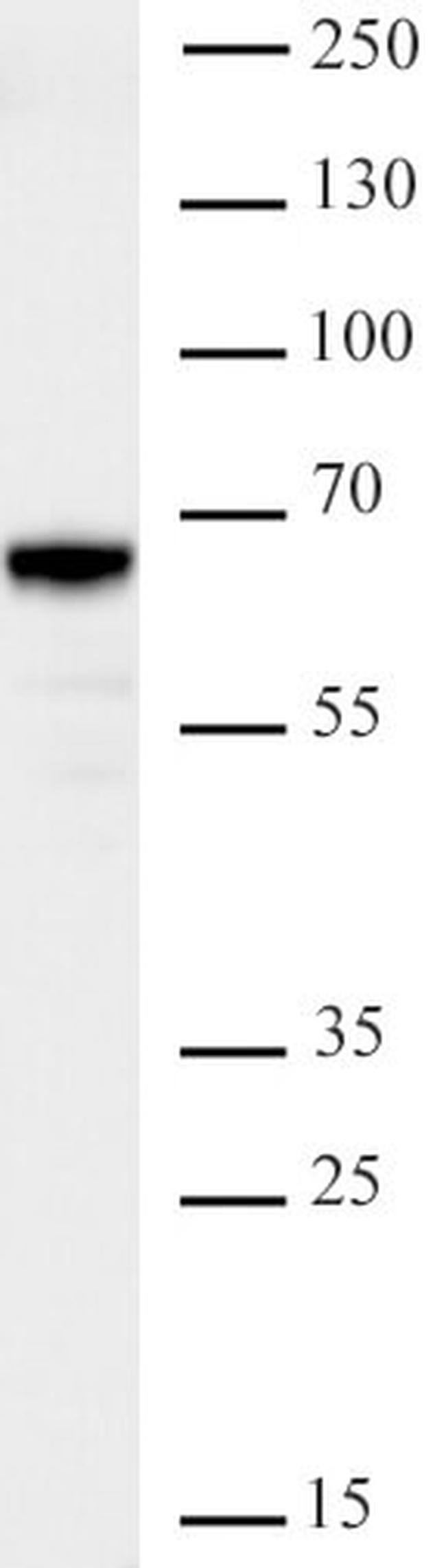 JMJD2D/KDM4D Antibody in Western Blot (WB)