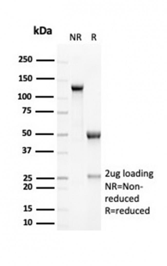 RCAS1/Estrogen Receptor Binding Site Associated Antigen 9 Antibody in Immunoelectrophoresis (IE)