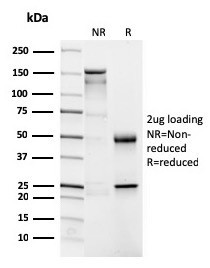 CD4 (T-Helper/Inducer Cell Marker) Antibody in SDS-PAGE (SDS-PAGE)