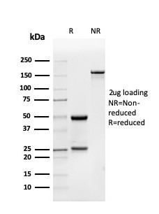 BMP15/GDF9B Antibody in SDS-PAGE (SDS-PAGE)