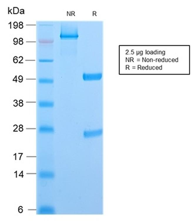 CD6 Antibody in SDS-PAGE (SDS-PAGE)