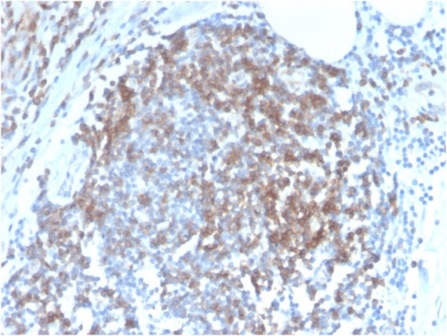 CD6 Antibody in Immunohistochemistry (Paraffin) (IHC (P))