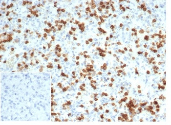 CD6 (Negative Marker of T-regulatory Cells) Antibody in Immunohistochemistry (Paraffin) (IHC (P))