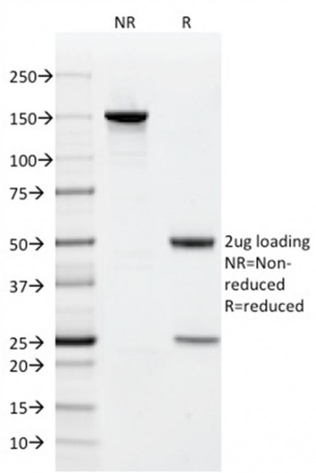 CD9 (TSPAN29) (Motility-Related Protein-1) Antibody in SDS-PAGE (SDS-PAGE)