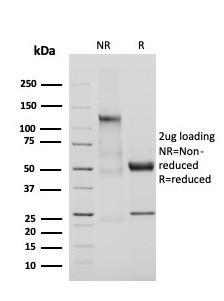Adiponectin (Marker of Obesity) Antibody in SDS-PAGE (SDS-PAGE)
