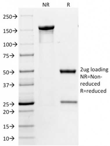 CD86 (Dendritic Cells Maturation Marker) Antibody in SDS-PAGE (SDS-PAGE)