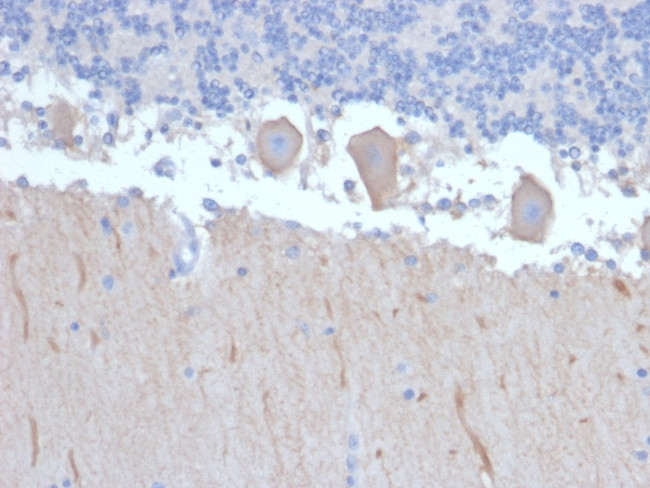 ATG5 Antibody in Immunohistochemistry (Paraffin) (IHC (P))