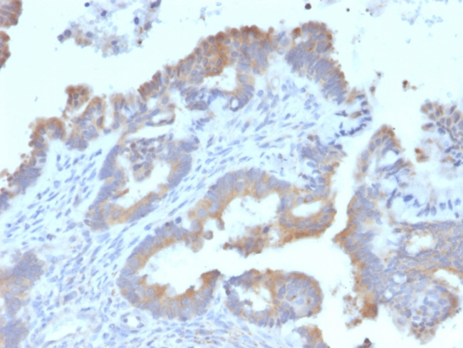 ATG5 Antibody in Immunohistochemistry (Paraffin) (IHC (P))