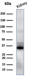 Napsin A (Lung Adenocarcinoma Marker) Antibody in Western Blot (WB)