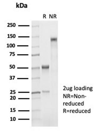 Napsin A (Lung Adenocarcinoma Marker) Antibody in SDS-PAGE (SDS-PAGE)