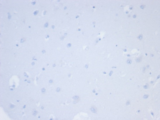 Napsin A (Lung Adenocarcinoma Marker) Antibody in Immunohistochemistry (Paraffin) (IHC (P))