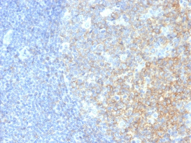 CD40/TNFRSF5/CD40L-Receptor Antibody in Immunohistochemistry (Paraffin) (IHC (P))