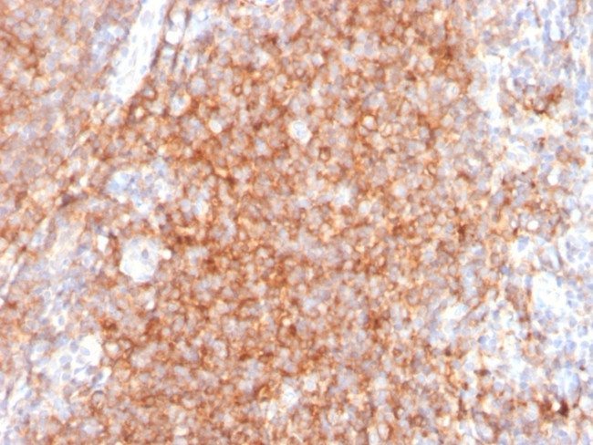 CD40/TNFRSF5/CD40L-Receptor Antibody in Immunohistochemistry (Paraffin) (IHC (P))