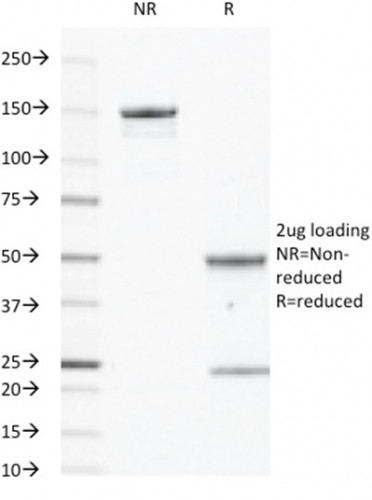 CD40/TNFRSF5/CD40L-Receptor Antibody in SDS-PAGE (SDS-PAGE)