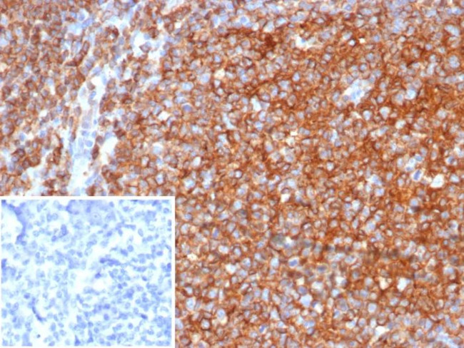 CD40/TNFRSF5/CD40L-Receptor Antibody in Immunohistochemistry (Paraffin) (IHC (P))