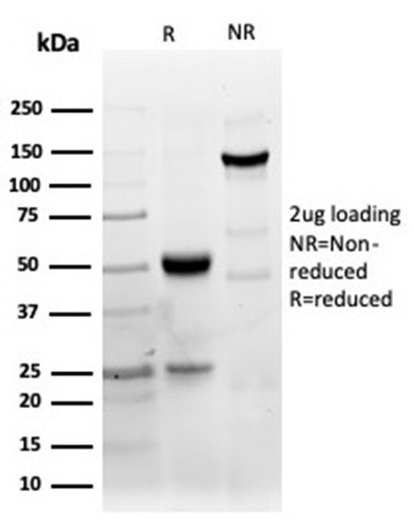 CD40/TNFRSF5/CD40L-Receptor Antibody in SDS-PAGE (SDS-PAGE)