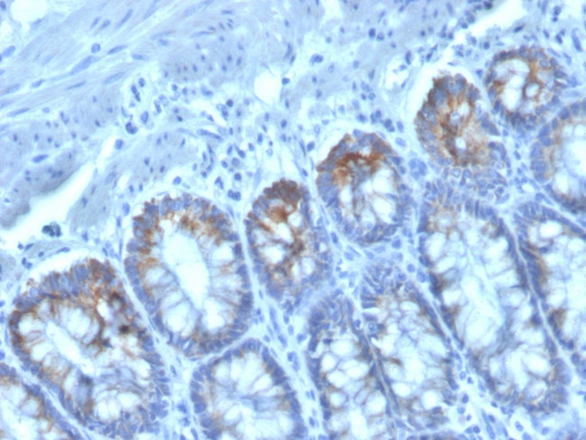 CD40 Ligand/CD154/TRAP1 (Activation Marker of T-Lymphocytes) Antibody in Immunohistochemistry (Paraffin) (IHC (P))