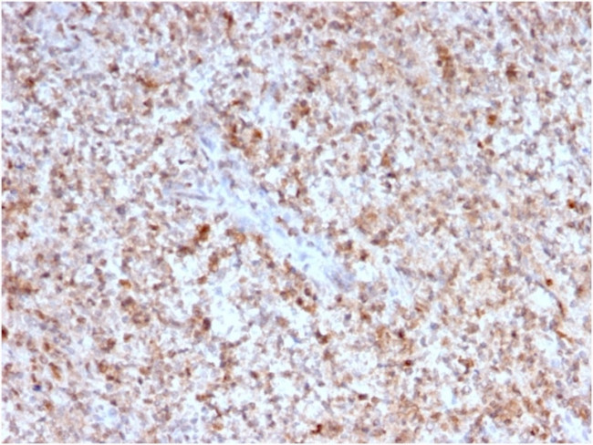 CD40 Ligand/CD154/TRAP1 (Activation Marker of T-Lymphocytes) Antibody in Immunohistochemistry (Paraffin) (IHC (P))