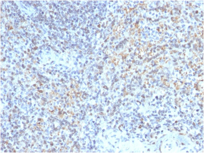 CD40 Ligand/CD154/TRAP1 (Activation Marker of T-Lymphocytes) Antibody in Immunohistochemistry (Paraffin) (IHC (P))