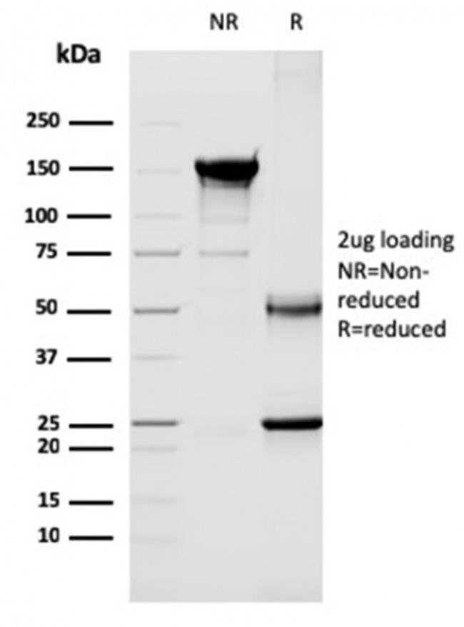 CD40 Ligand/CD154/TRAP1 (Activation Marker of T-Lymphocytes) Antibody in SDS-PAGE (SDS-PAGE)