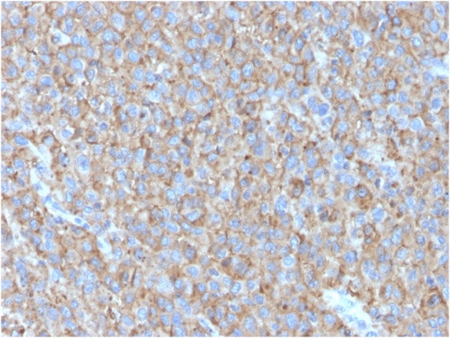 CD63 Antibody in Immunohistochemistry (Paraffin) (IHC (P))