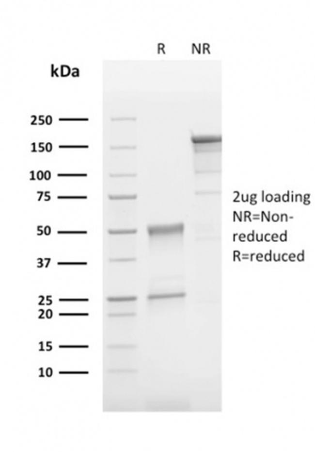 CD63 Antibody in SDS-PAGE (SDS-PAGE)