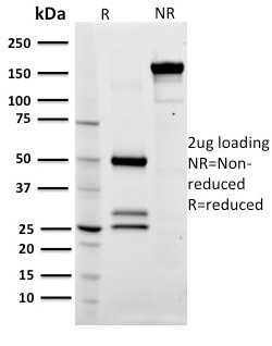 CD79a (B-Cell Marker) Antibody in SDS-PAGE (SDS-PAGE)