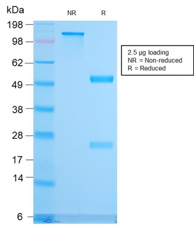 CD79b Antibody in SDS-PAGE (SDS-PAGE)