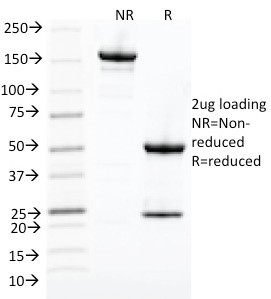 Cdk1/p34cdc2 Antibody in SDS-PAGE (SDS-PAGE)