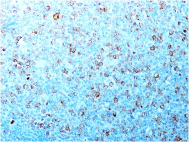 Cdk1/p34cdc2 Antibody in Immunohistochemistry (Paraffin) (IHC (P))