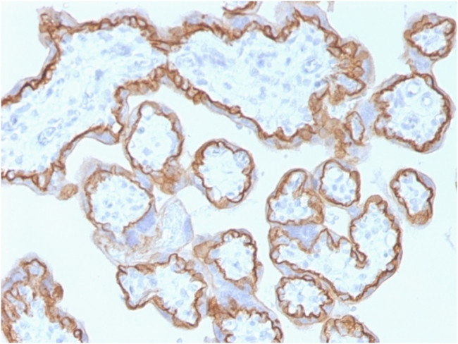 E-Cadherin (CDH1)/CD324 (Intercellular Junction Marker) Antibody in Immunohistochemistry (Paraffin) (IHC (P))