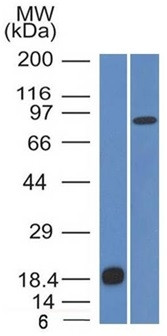 E-Cadherin (CDH1)/CD324 (Intercellular Junction Marker) Antibody in Western Blot (WB)