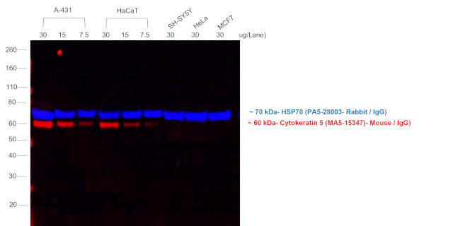 Mouse IgG (H+L) Cross-Adsorbed Secondary Antibody in Western Blot (WB)