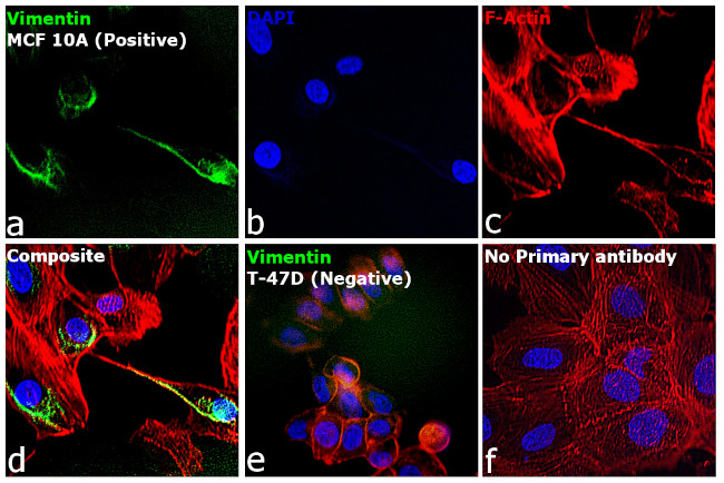 Rabbit IgG (H+L) Cross-Adsorbed Secondary Antibody in Immunocytochemistry (ICC/IF)