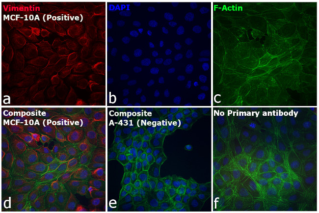 Rabbit IgG (H+L) Cross-Adsorbed Secondary Antibody in Immunocytochemistry (ICC/IF)